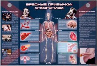 Электрифицированный стенд "Вредные привычки: алкоголизм" - fgospostavki.ru - Шуя