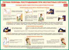 Таблица "Порядок действий при опасном кровотечении" (100х140 сантиметров, винил) - fgospostavki.ru - Шуя